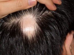 La máscara ecolab activa el crecimiento de los cabello