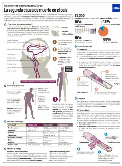 infografia_derrame_cerebral